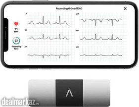 KardiaMobile 6-Lead Personal EKG Monitor – Six Views of The Heart