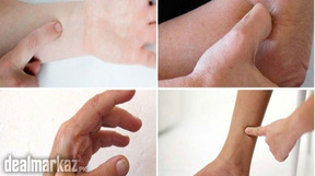 Best Acupuncture and Acupressure Clinic Center