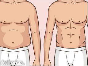 Liposuction in Lahore - Cosmeticoplasty