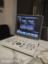 APOLLO 11 QUEEN LATEST .USED NOTE BOOK ULTRASOUND MACH INE