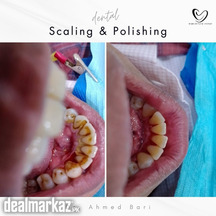 Discover the Best Dental Clinic in Karachi