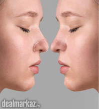 cosmeticoplasty