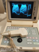 CHINA SECOND HAND.NAI JESI DIBBA PAK ULTRASOUND MACHINE USED K RATE MA