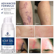 Silicon Scar Removal Gel Price in Pakistan
